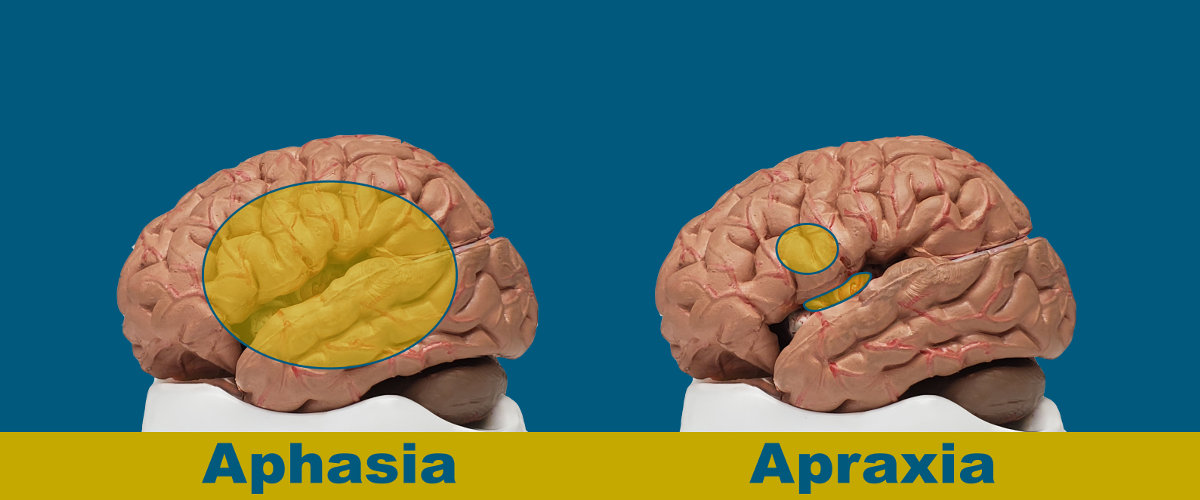 what-s-the-difference-between-aphasia-and-apraxia-the-aphasia-center